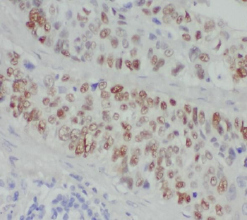 ZMYND8 Rabbit Polyclonal Antibody