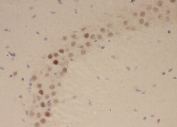 ZBTB18 Rabbit Polyclonal Antibody