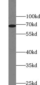 ZNF410 Rabbit Polyclonal Antibody