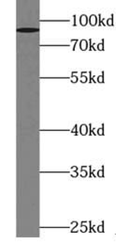 ZNF746 Rabbit Polyclonal Antibody