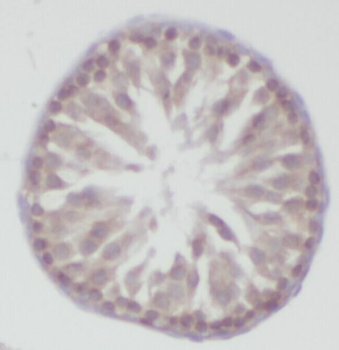 ZNF746 Rabbit Polyclonal Antibody