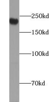 TJP1 Rabbit Polyclonal Antibody