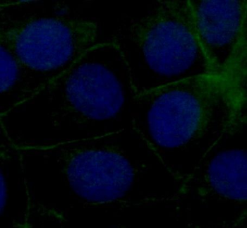 TJP1 Rabbit Polyclonal Antibody