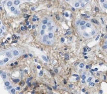 TJP1 Rabbit Polyclonal Antibody