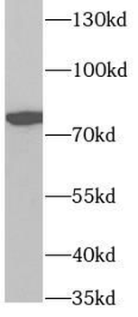 ZYX Rabbit Polyclonal Antibody