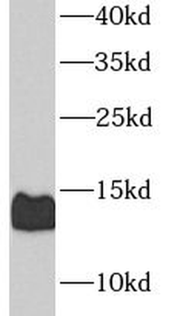 CALCB Rabbit Polyclonal Antibody