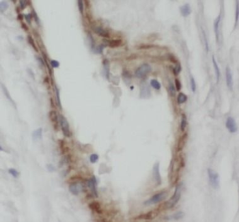 CALCB Rabbit Polyclonal Antibody