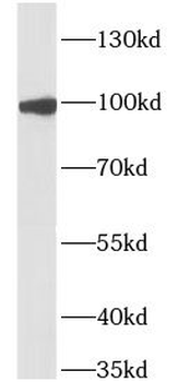 IL17RA Rabbit Polyclonal Antibody