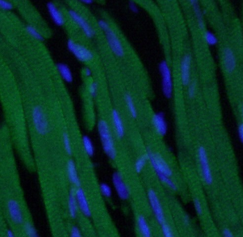 cTnI Mouse Monoclonal Antibody