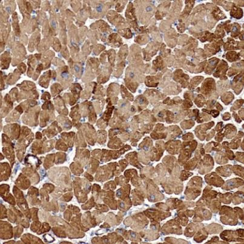cTnI Mouse Monoclonal Antibody
