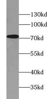 MAP3K3 Rabbit Polyclonal Antibody