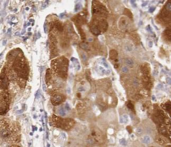 MAP3K3 Rabbit Polyclonal Antibody