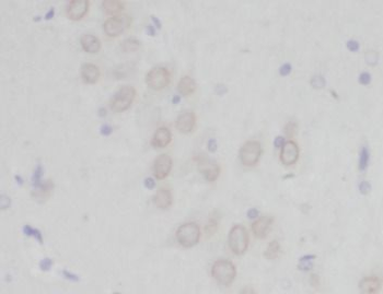 PCDH10 Rabbit Polyclonal Antibody