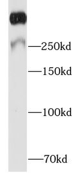 MKI67 Rabbit Polyclonal Antibody