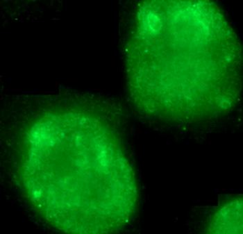 MKI67 Rabbit Polyclonal Antibody