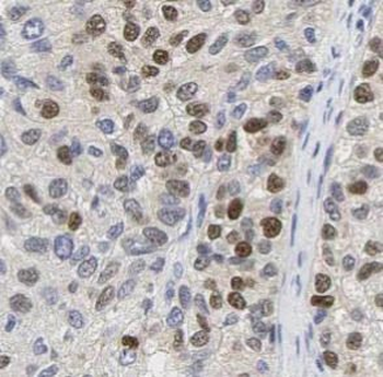 MKI67 Rabbit Polyclonal Antibody