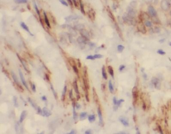 ELN Rabbit Polyclonal Antibody