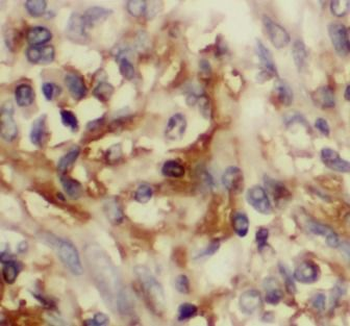 CCL20 Rabbit Polyclonal Antibody
