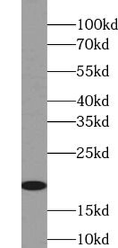 Phospho CD3 ζ (Tyr142) Rabbit Polyclonal Antibody