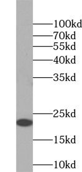 Asprosin Rabbit Polyclonal Antibody