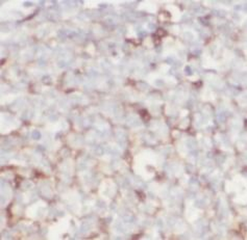 CD80 Mouse Monoclonal Antibody