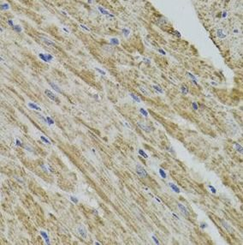 FHIT Rabbit Polyclonal Antibody