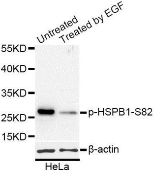 Phospho HSPB1 (S82) Rabbit Polyclonal Antibody