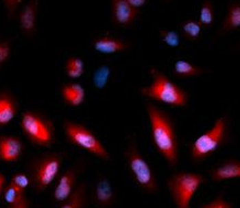 Phospho HSPB1 (S82) Rabbit Polyclonal Antibody