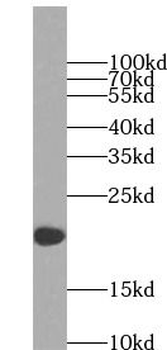 IL2 Rabbit Polyclonal Antibody