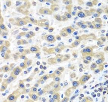 IL2 Rabbit Polyclonal Antibody