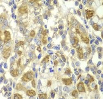 TNF alpha Rabbit Polyclonal Antibody