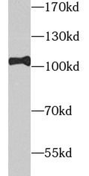 TOP1 Rabbit Polyclonal Antibody