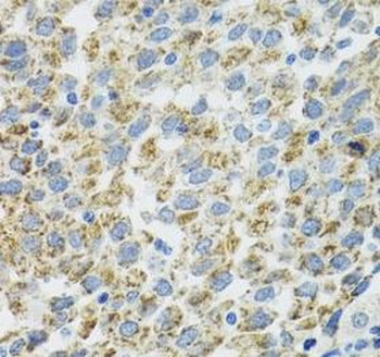 TXN2 Rabbit Polyclonal Antibody