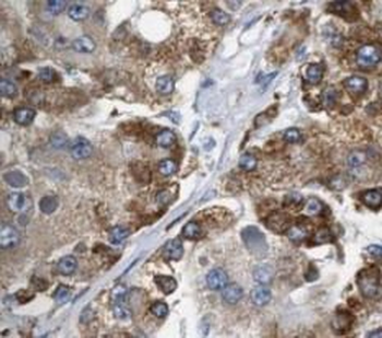 MAP3K3 Rabbit Polyclonal Antibody