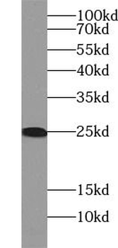 RPL29 Rabbit Polyclonal Antibody
