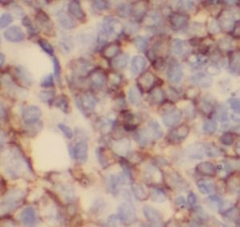 TLR4 Mouse Monoclonal Antibody