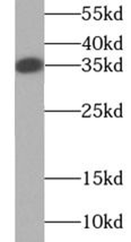 TNFSF11 Mouse Monoclonal Antibody