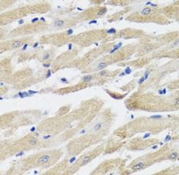 NPPA Rabbit Polyclonal Antibody