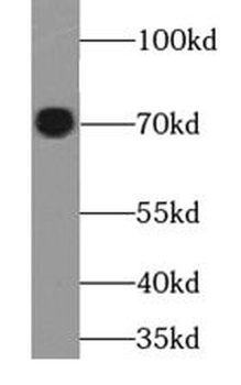 DVL1 Rabbit Polyclonal Antibody