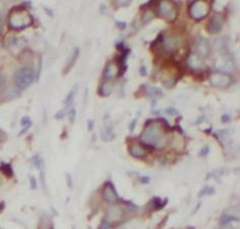 DVL1 Rabbit Polyclonal Antibody