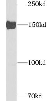 ATP7B Rabbit Polyclonal Antibody