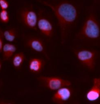 ATP7B Rabbit Polyclonal Antibody