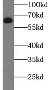 SQSTM1 Mouse Monoclonal Antibody