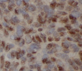 SQSTM1 Mouse Monoclonal Antibody