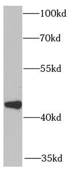 CXCR3 Rabbit Polyclonal Antibody