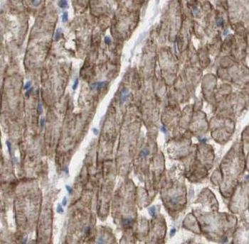 CXCR3 Rabbit Polyclonal Antibody
