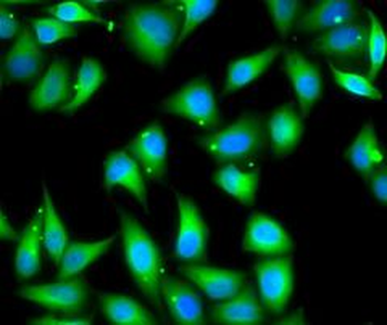 MYL3 Rabbit Polyclonal Antibody