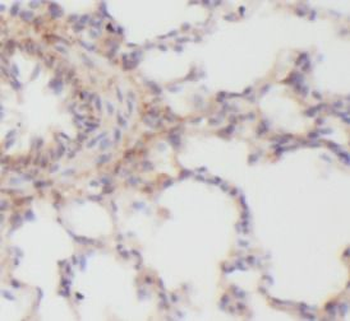 CXCL8 Rabbit Polyclonal Antibody