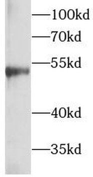 Beta Tubulin Rabbit Polyclonal Antibody