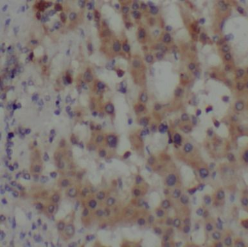 Beta Tubulin Rabbit Polyclonal Antibody